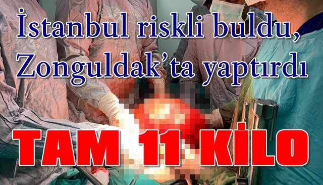 Karnından 11 kiloluk kitle çıktı