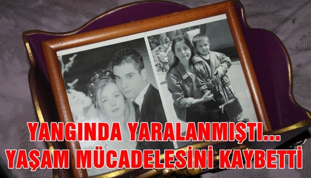 YANGINDA YARALANMIŞTI... YAŞAM MÜCADELESİNİ KAYBETTİ