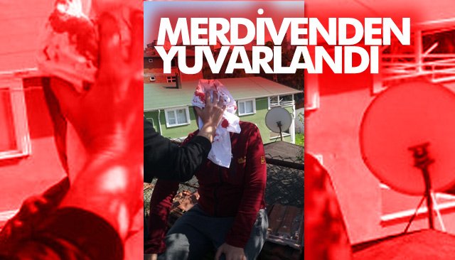 MERDİVENDEN YUVARLANDI