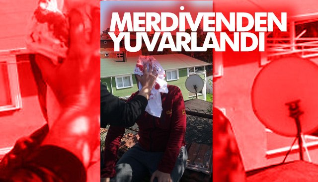 MERDİVENDEN YUVARLANDI