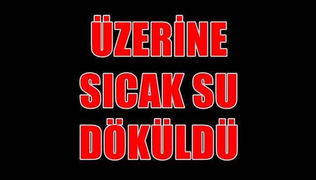 ÜZERİNE SICAK SU DÖKÜLDÜ