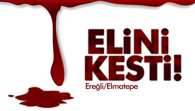 ELİNİ KESTİ!