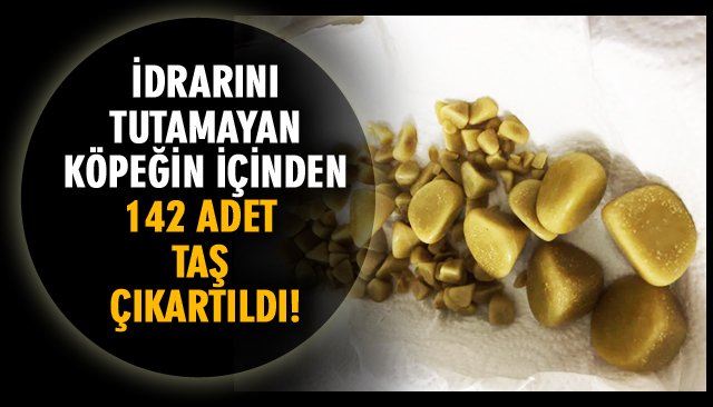 İDRAR KESESİNDEN 142 ADET TAŞ ÇIKARTILDI! 