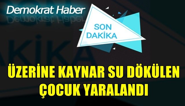 Küçük çocuğun üzerine kaynar su döküldü   