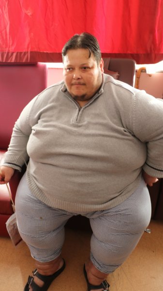 217 kiloyla yürüyemeyecek hale geldi, tüp mide ameliyatı oldu… KİLOLARINDAN KURTULACAK - 3