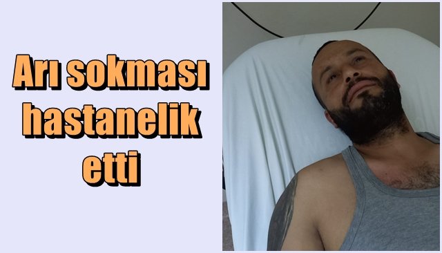 Arı sokması hastanelik etti