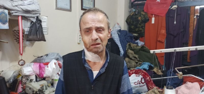 Devrek’te cinayetle biten kavganın nedeni… Talihsiz koca konuştu… VAHŞETİ ANLATTI! - 1