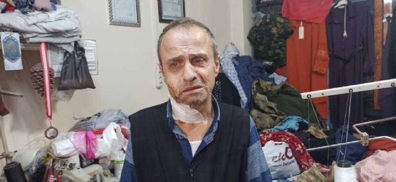Devrek’te cinayetle biten kavganın nedeni… Talihsiz koca konuştu… VAHŞETİ ANLATTI! - 2