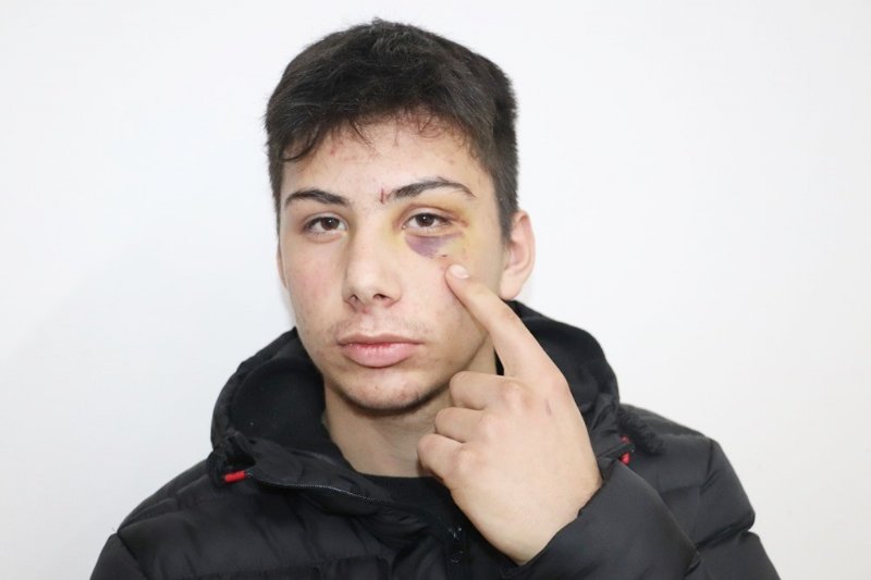 Haksız yere darp edildi, tedirginliği sürüyor... ADALET İSTİYOR - 3