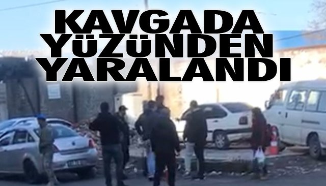 KAVGADA YÜZÜNDEN YARALANDI