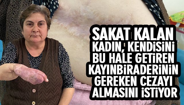 SAKAT KALAN KADIN, KENDİSİNİ BU HALE GETİREN KAYINBİRADERİNİN GEREKEN CEZAYI ALMASINI İSTEDİ