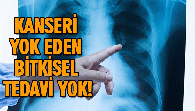 AKCİĞER KANSERİ EN SIK GÖRÜNEN KANSER