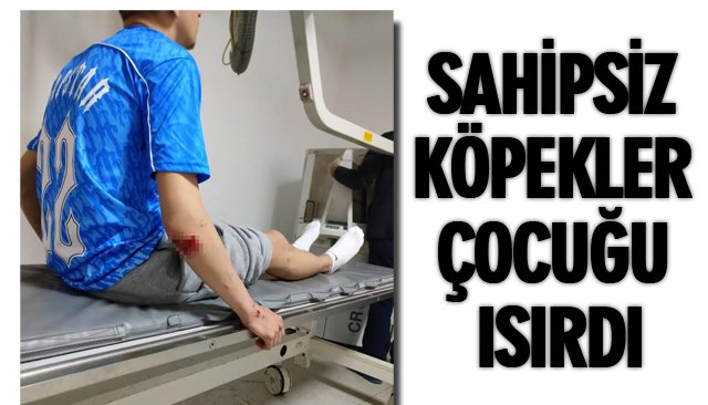 SAHİPSİZ KÖPEKLER ÇOCUĞU ISIRDI