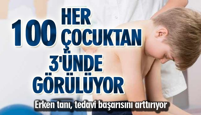 HER 100 ÇOCUKTAN 3´ÜNDE GÖRÜLÜYOR