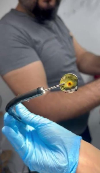 DÖRT YILDIR KUSAN  MUSTAFA VAKUM YUTMUŞ! - 3