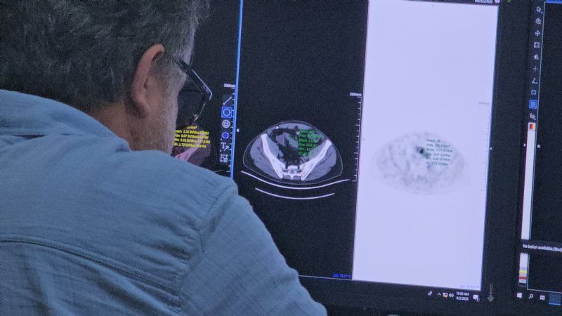 BEUN PET-CT, AVRUPA AKREDİTASYONU ALDI - 3